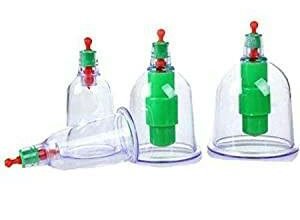 ما هى واسعار الحجامة فى السعودية 24 أسعار الحجامة